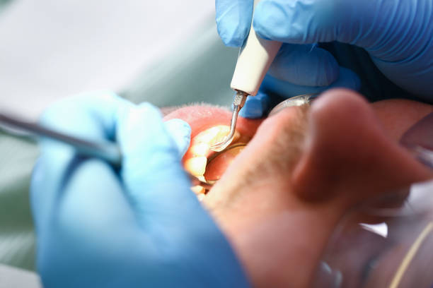 Best Broken or Cracked Tooth Emergency Dentist in Monument, CO